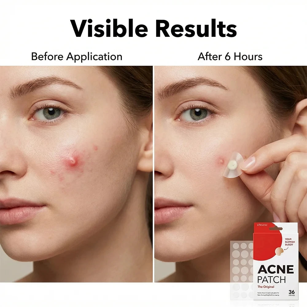 Invisible Hydrocolloid Acne Patches